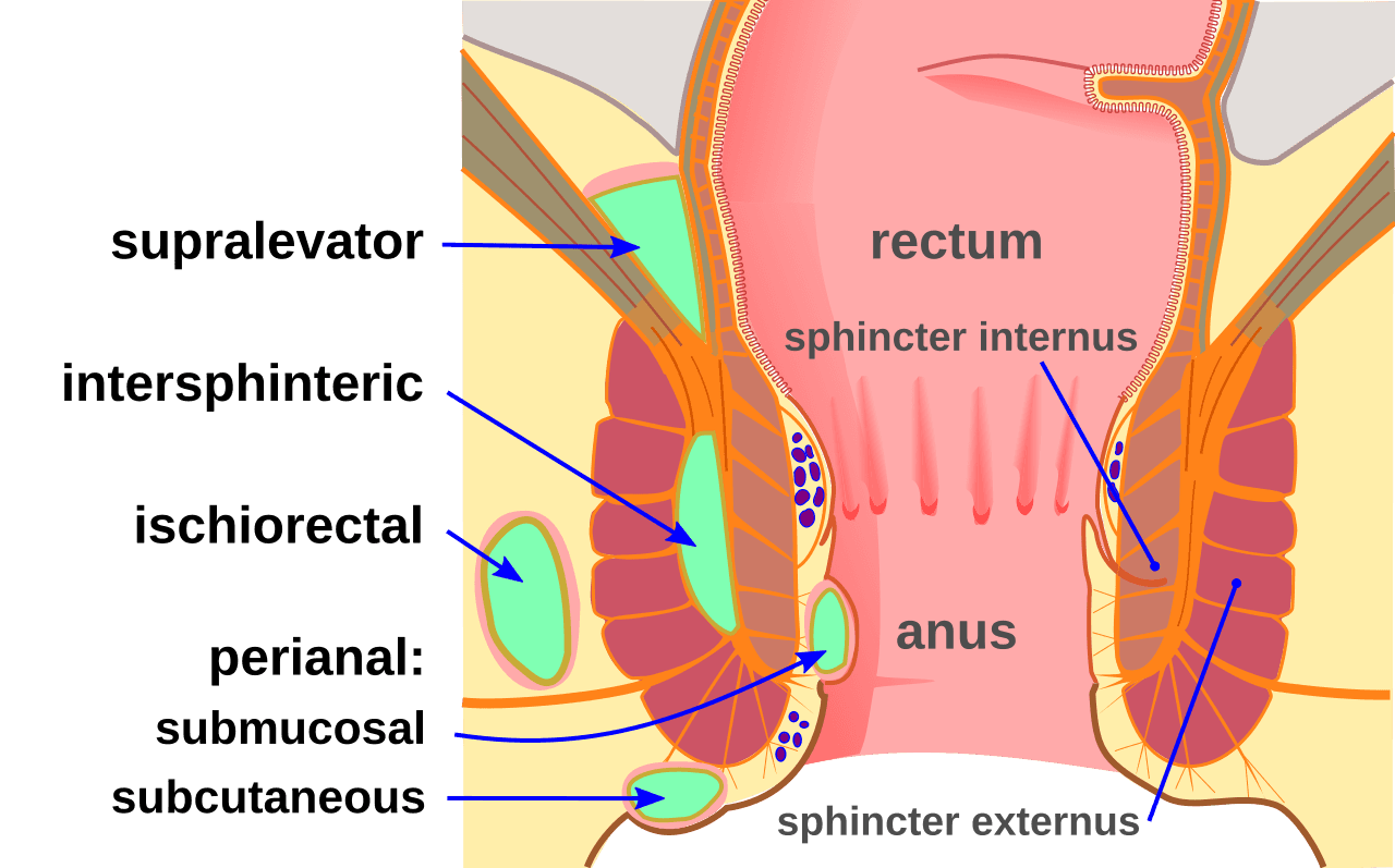 Perianal Abscess Diagram